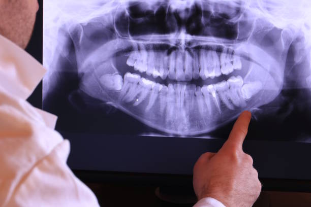 Best Emergency Tooth Extraction in Reliez Valley, CA